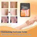 Patch Kundër Variçeve “Varicose Veins” - Figura 2