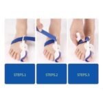 Korrektor për Gishta të Këmbës - Figura 3