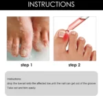 Vaj Për Heqjen e Thonjve të Brendshëm Ingrown Toenail Drops - Figura 2