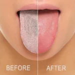 Pastrues Gjuhe – Tongue Cleaner (2 cope) - Figura 2