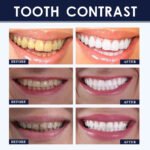 Pluhur Zbardhues për Dhëmbë - Figura 3