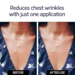 Maskë Silikoni Kundër Rrudhave - Figura 2