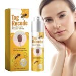 Spray për Heqje Lythash